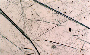 Asbestos microscope Asbestos microscope